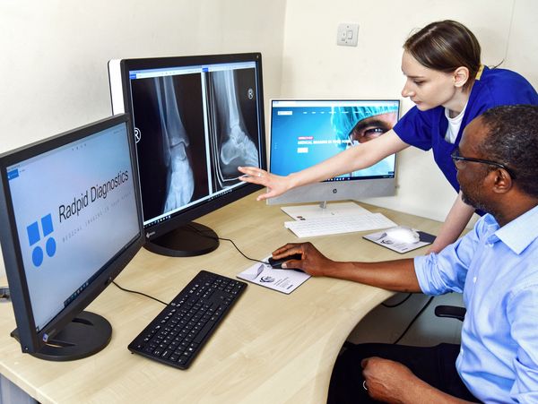 Two medical professionals analyzing ankle X-rays on computer screens in a clinical setting.
