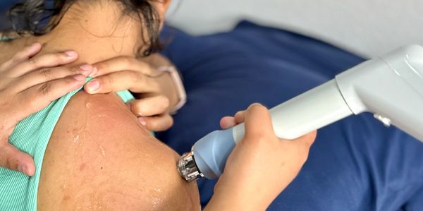 Tratamiento dermatológico en el hombro.