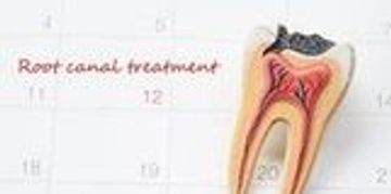 RootCanal Treatment, cheap root canal treatment, root canal, inexpensive rootcanal