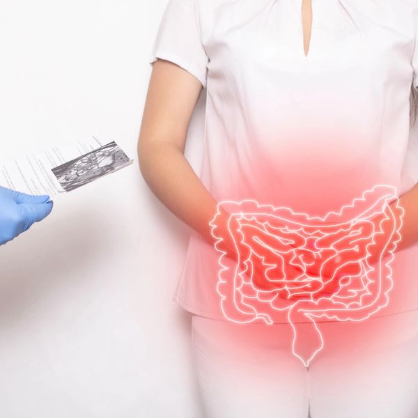 What is inflammation?