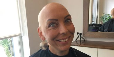 cancer-related-hair-loss-liverpool.webp