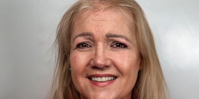 womens-hair-loss-liverpool-crlab.webp