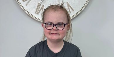 childrens-alopecia-liverpool.webp