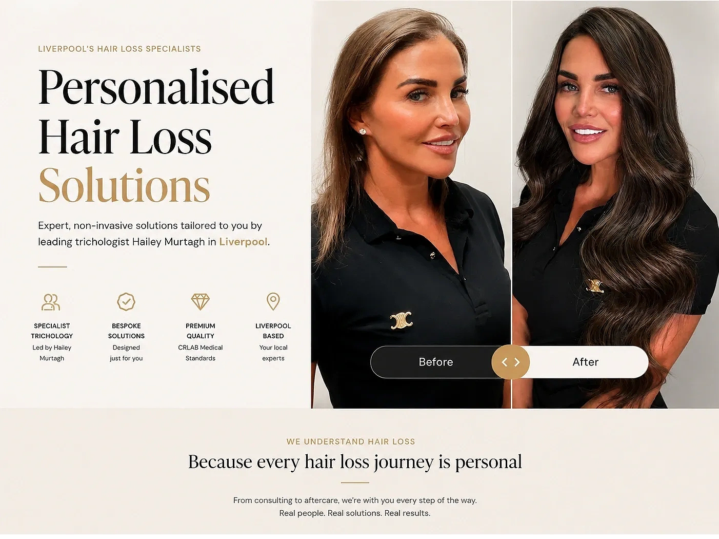 crlab-liverpool-personalised-hair-loss-solutions-hailey-murtagh-hero.webp