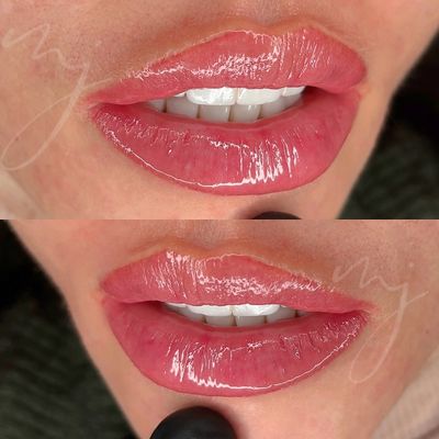 Lip blush | lip blush Sydney | best lip blush Sydney | lip tattoo sydney