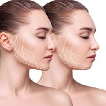 Facial Filler Horsham
Jaw Filler Horsham
Cheek Filler Horsham
Jaw Filler Horsham
Chin Filler Horsham