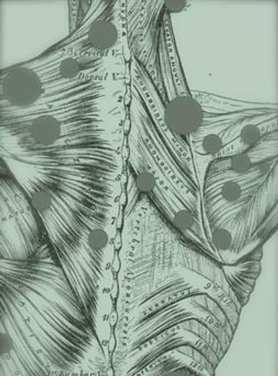 Trigger Points