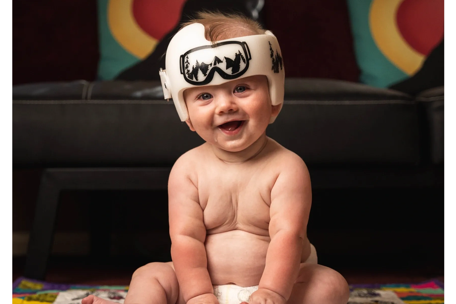 A baby sits on the floor with a cranial device. The helmet has a ski goggle design on the front