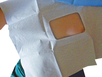 Medical drape with window for surgical procedure on a patient's torso.