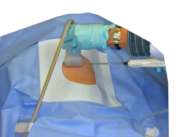 Medical professional performing an ultrasound-guided injection on a patient's shoulder.