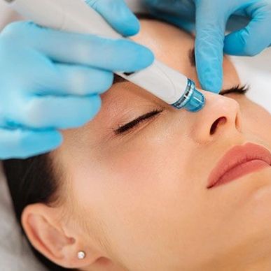 Hydro Facial Treatment Bromsgrove