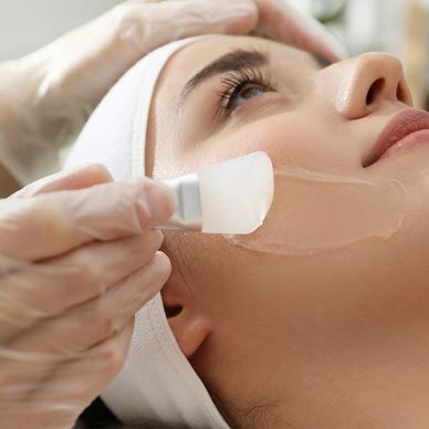 Chemical Skin Peel Facial Treatment Bromsgrove