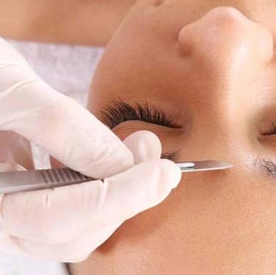 Dermaplaning facial treatment bromsgrove Worcestershire