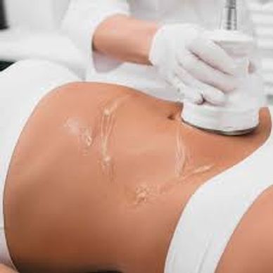 Ultrasonic Fat Cavitation / Non Surgical Liposuction treatment Bromsgrove