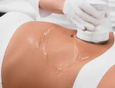 Ultrasonic Fat Cavitation / Non Surgical Liposuction Treatment Bromsgrove