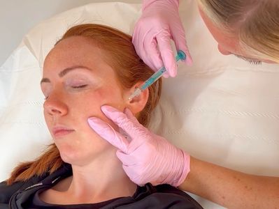 skin booster treatment bromsgrove