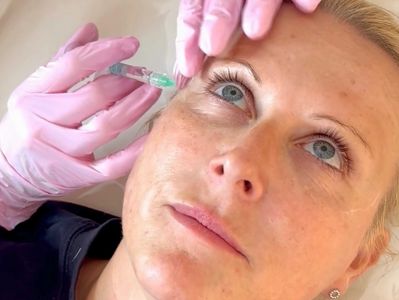 polynucleotide treatment bromsgrove lumi eyes