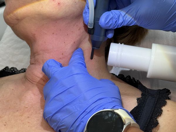 Examen dermatológico con equipo especializado.