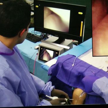 Video orthopedic Microsurgery, video ENT microsurgery, microprocedure video