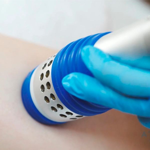 reductor corporal ondas de choque