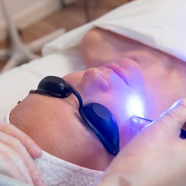 laser azul milesman blauman