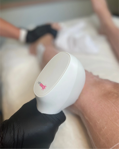 IPL Hair removal 