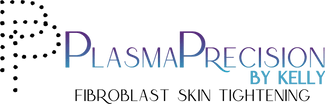 PlasmaPrecision by Kelly