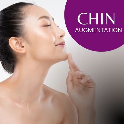 Before and after chin augmentation by Dr. Aicee Bernal, plastic surgeon in Manila