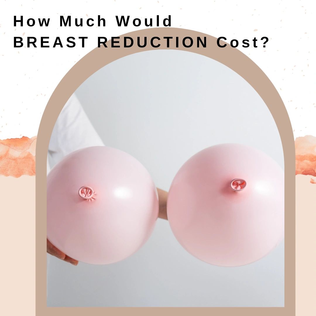 Cost of breast reduction Cost of breast reduction