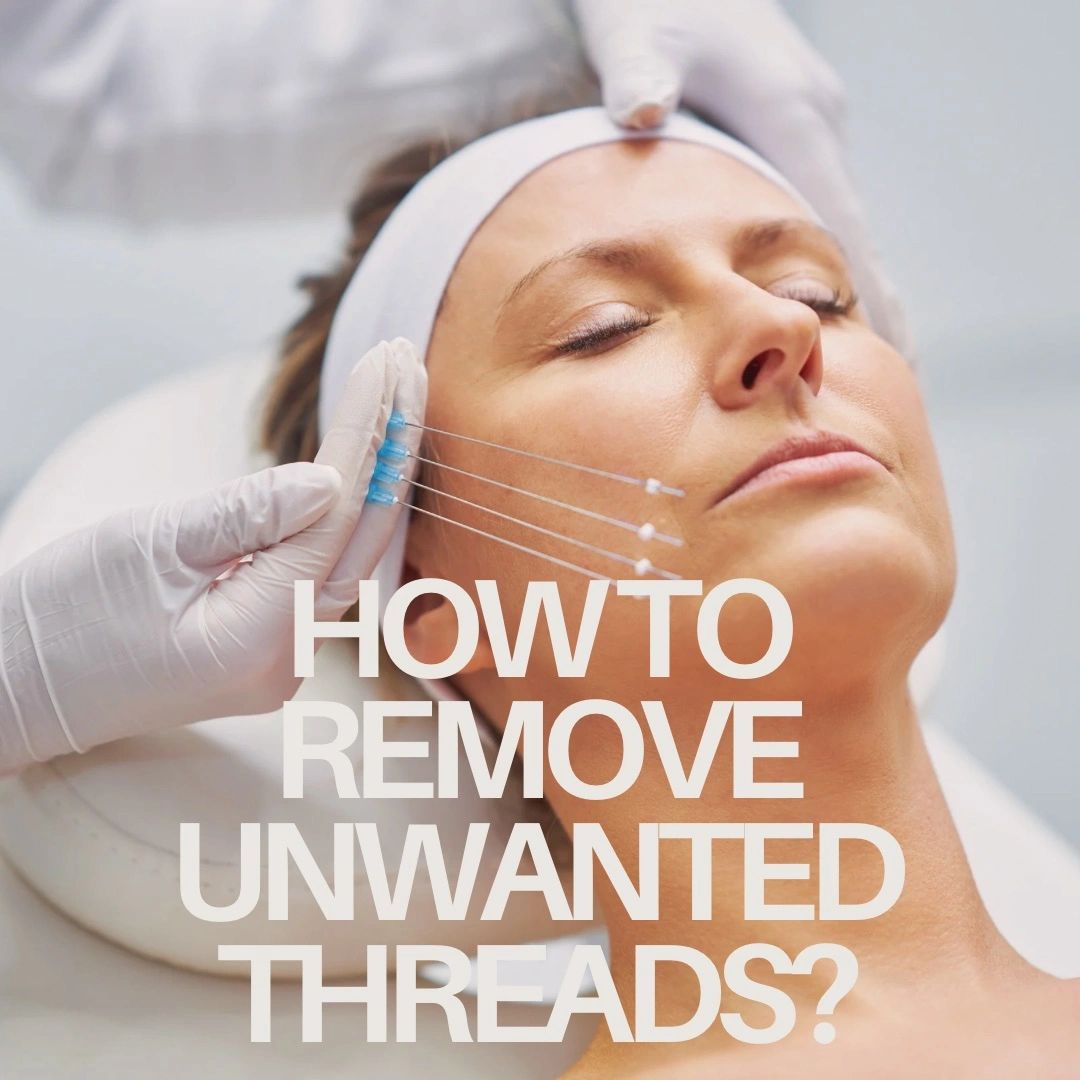 Can you remove unwanted facial threads?