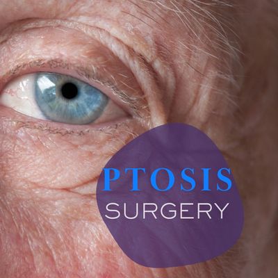 Eyelid Ptosis surgery is a plastic surgery for lazy eye or uneven eyes or drooping eyelids