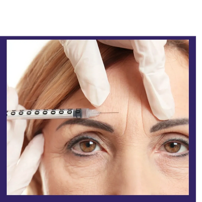 Before and after Botox injections by Dr. Aicee Bernal, wrinkle treatment in Manila