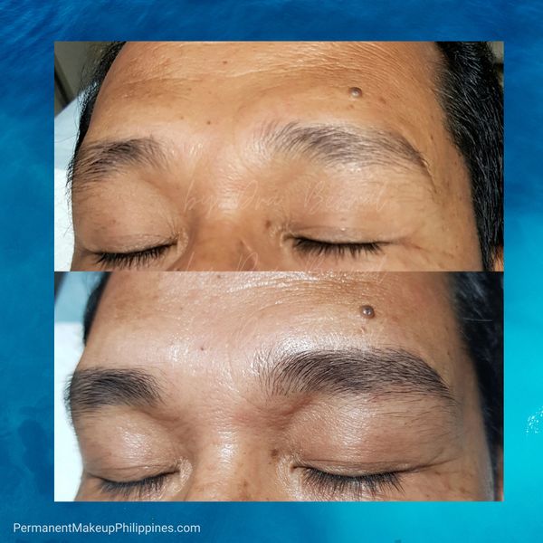Male Eyebrow Microblading before and after by Dr Bernal