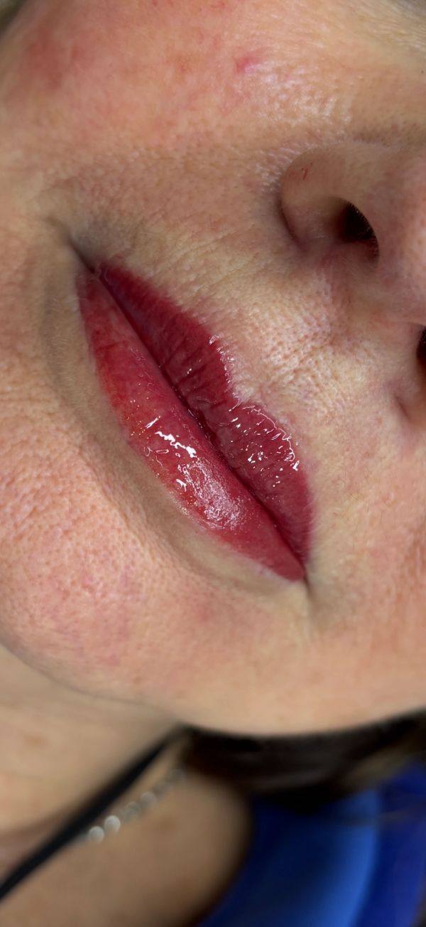 Close-up of glossy, red lips and part of the nose on textured skin.