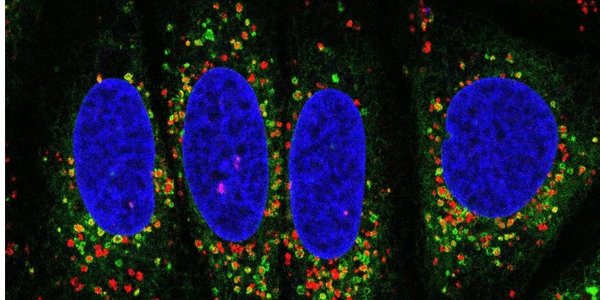 Extensive ER (green)/lysosome (red) contacts