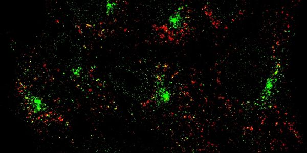 Dynamic contacts between lysosomes and innate immune signaling complexes