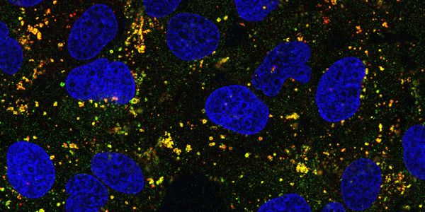 Damaged lysosomes are decorated by a lipid kinase