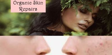 Before and after images of acne skin repair with organic treatment.
