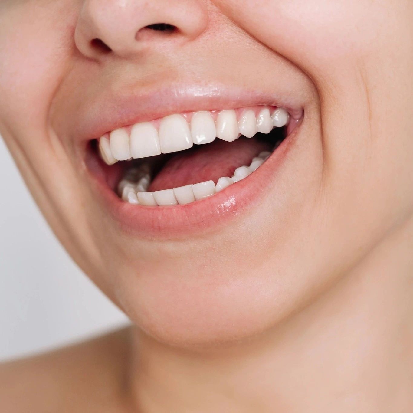 Whitening