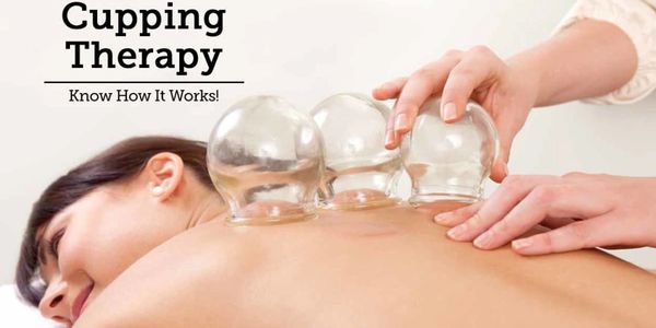 Cupping Therapy