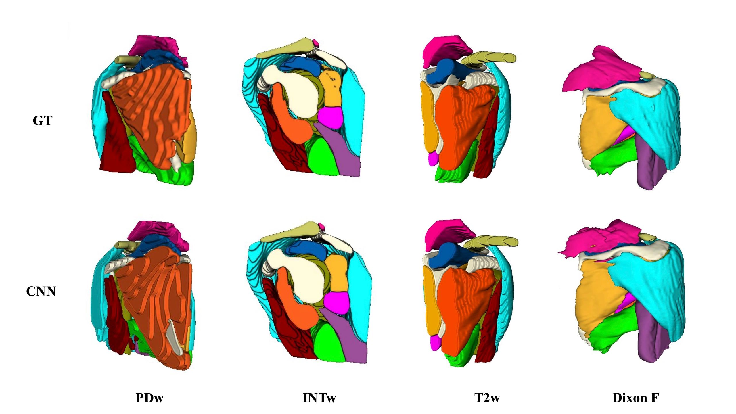 Muscle Imaging: The MuscleMap Project by James M. Elliott