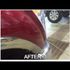 Dent After