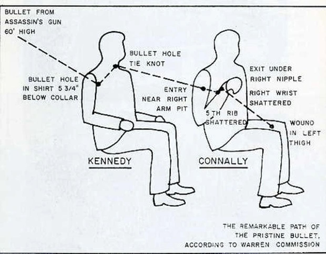Diagram showing the path of the bullet through Kennedy and Connally's bodies in the Warren Commission report.