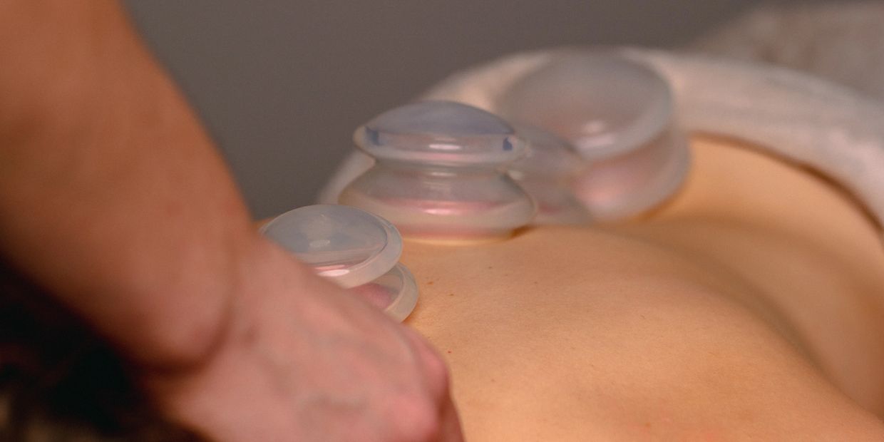 Massage aux ventouses, clinique de massothérapie à Saint-Sauveur