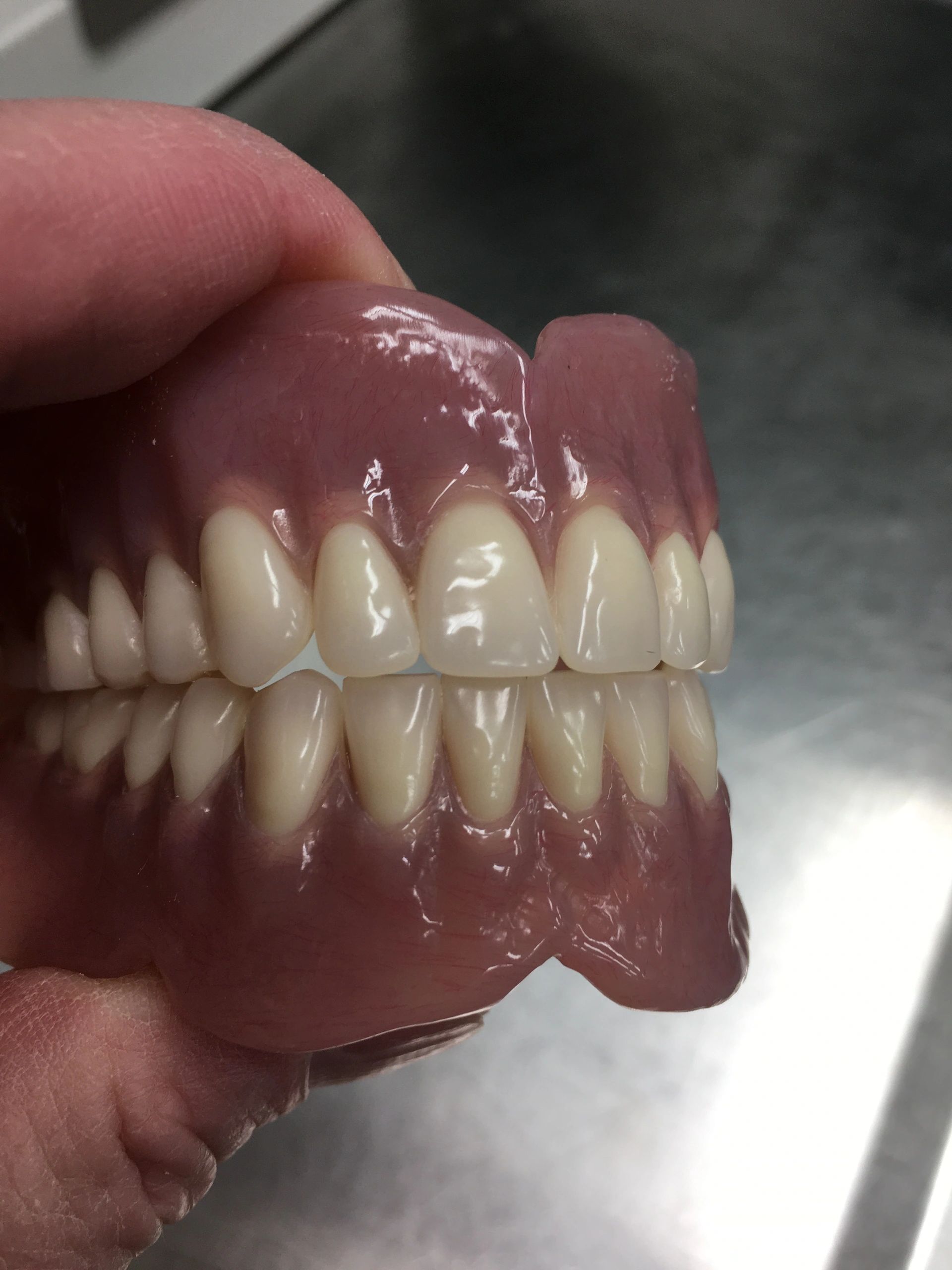 Denture Tech Dental Laboratory Denture Laboratory, Dentures