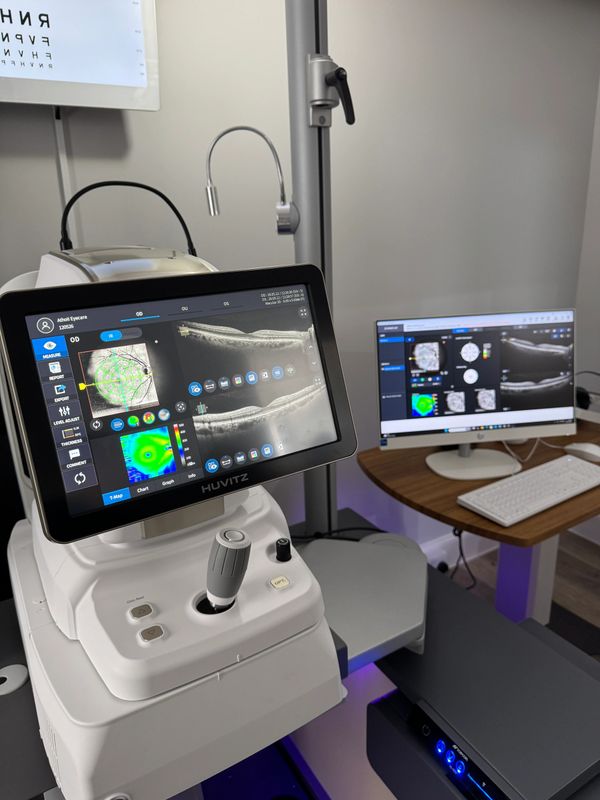 Optical coherence tomography machine displaying retinal scans in a clinical setting.