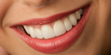 Sourire esthétique. Dents droites et blanches. Dentisterie esthétique
