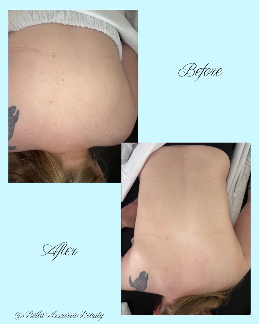 Client after receiving a relaxing back facial 