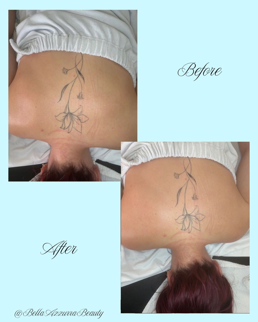 Client after receiving relaxing back facial