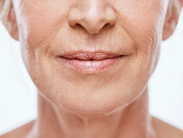 Close-up of mature skin showing natural fine lines & wrinkles.